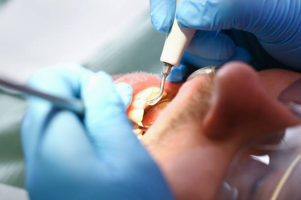 Best Emergency Treatment for Dental Infections or Abscesses in Holtsville, NY