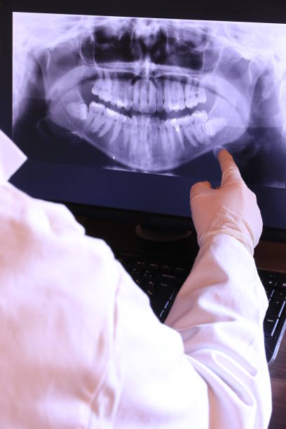 Best Emergency Wisdom Teeth Removal in Holtsville, NY